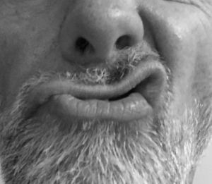 holidazed and contused-3